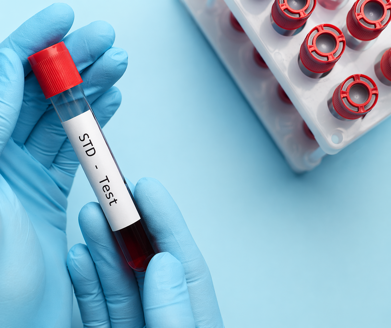 STD test vial in gloved hand